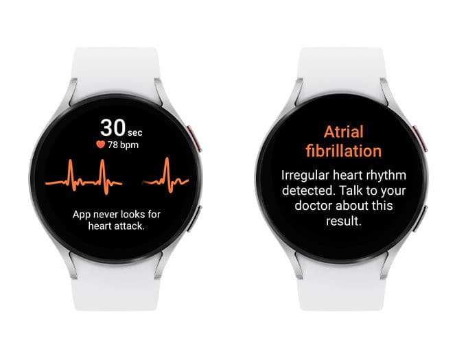 Galaxy Watch irregular heart rhythm notification cleared by FDA
